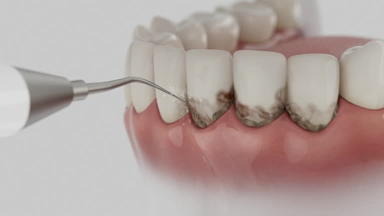 Trusted Tooth Extraction service in Black Jack, MO - Dentist Open Now